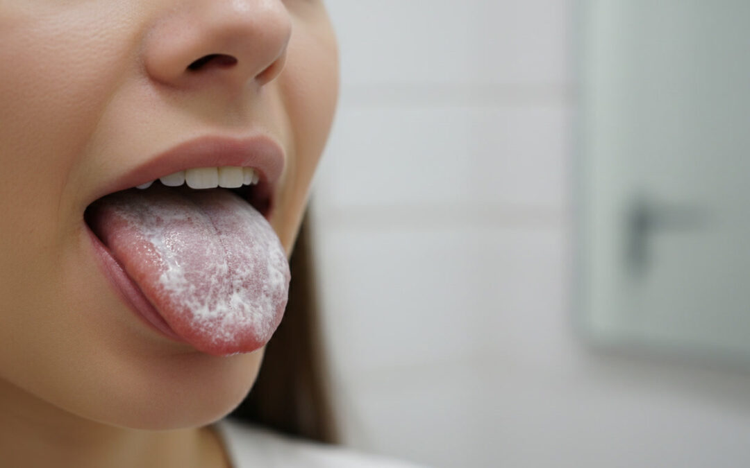 The Tongue Coating Test: What Color Tells You About Your Breath